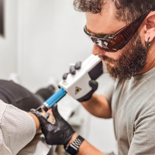 Eliminación de tatuajes en Zian Tattoo